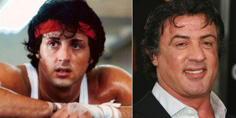 Estos son algunos desastres de la cirug&iacute;a est&eacute;tica en famosos