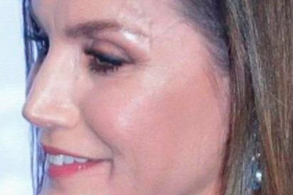 Las arrugas y marcas de venas en la frente de Letizia sorprenden a las redes
