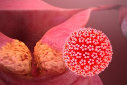 La ignorancia que propaga el c&aacute;ncer de cuello uterino