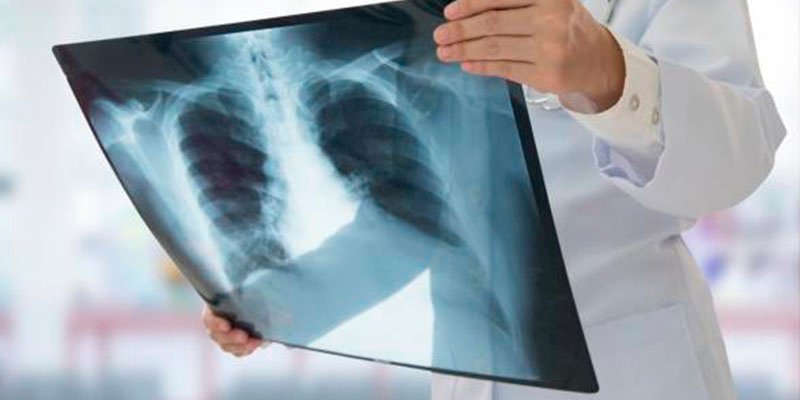 La vida en Nepal tiene este efecto en los huesos de los humanos