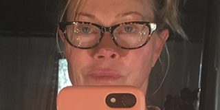 Melanie Griffith enseña el efecto del cáncer de piel en su propia nariz