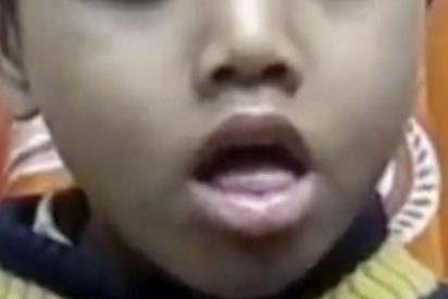 Este ni&ntilde;o se traga un silbato y ahora tose as&iacute;&hellip;