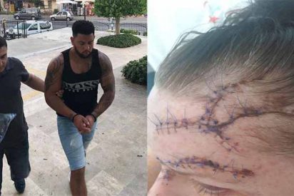 La brutal paliza que recibi&oacute; una turista tras negarse a tener sexo en Turqu&iacute;a