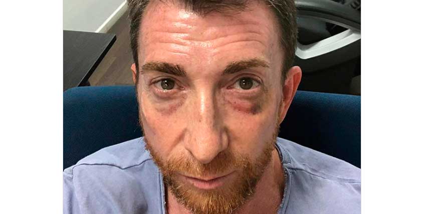 Pablo Motos: "Amo el boxeo... pero a veces te pegan una hostia"