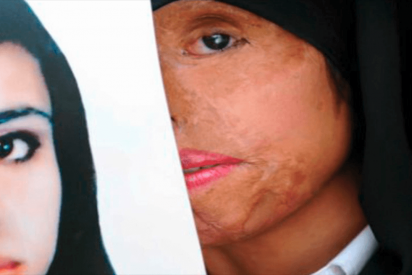 Crean un maquillaje que &ldquo;protege&rdquo; a las mujeres de las quemaduras con &aacute;cido