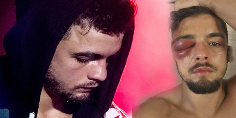 Este boxeador sufre una impactante lesión en el ojo durante una pelea