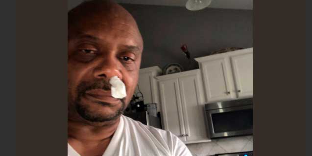 Le goteaba la nariz y no era un resfriado ni alergia: result&oacute; ser l&iacute;quido cefalorraqu&iacute;deo