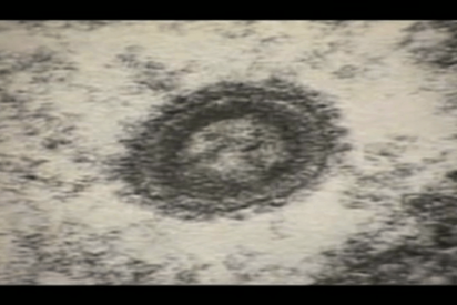 (1985) Rock Hudson muere de SIDA