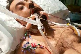 El asalto a un hombre que conmociona al mundo: le cortan las orejas frente a su hijo y lo dejan en estado vegetal