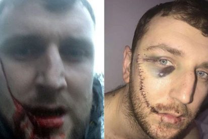 Participa de una batalla de ultras en Inglaterra y termina con la sonrisa del Joker