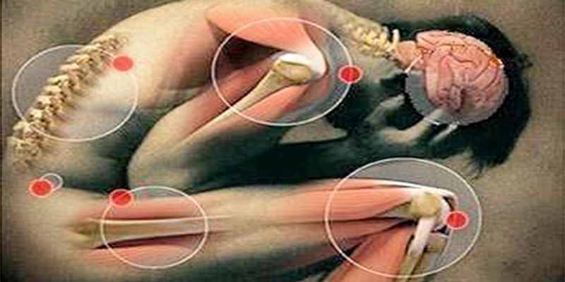 Investigadores descubren una nueva enfermedad esquelética rara