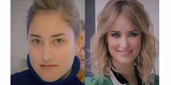 Asi era Alba Carrillo antes de pasar por la cirugía estética y operarse la cara