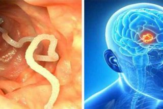 &iexcl;Acab&oacute; con par&aacute;sitos en su cerebro despu&eacute;s de tomar un caldo!