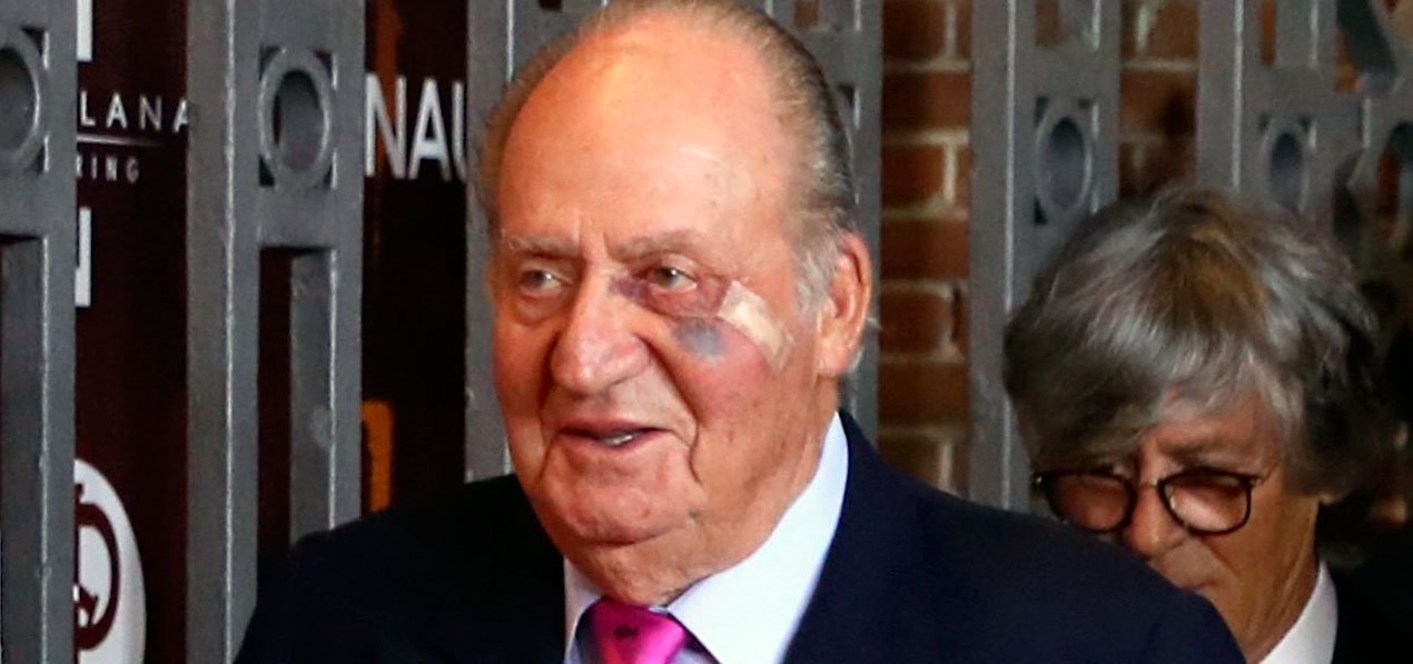 La impactante aparici&oacute;n del rey em&eacute;rito Juan Carlos I con un enorme morat&oacute;n en su ojo izquierdo