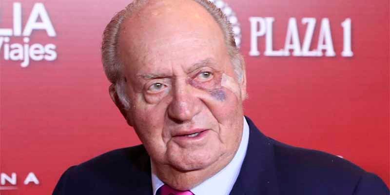 El rey Juan Carlos I reaparece en p&uacute;blico con un tremendo morat&oacute;n en un ojo