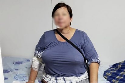 Entra al quir&oacute;fano por una liposucci&oacute;n y termin&oacute; con gangrena en el abdomen
