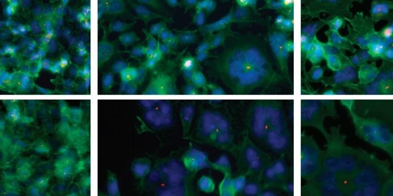 Descubren un posible tratamiento contra el cáncer de mama y ovario