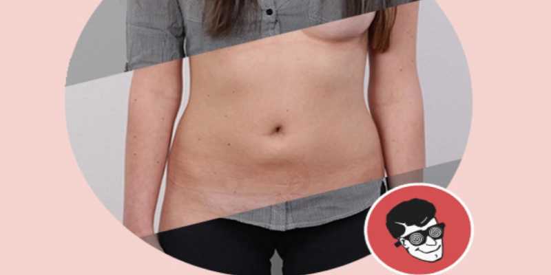 DeepNude: La vil app que &ldquo;desnuda&rdquo; a las mujeres usando IA