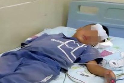 As&iacute; sacan una sanguijuela viva de 8 cent&iacute;metros de la garganta de un ni&ntilde;o que estuvo tosiendo sangre durante diez d&iacute;as