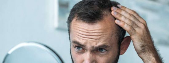 Precauciones y riesgos antes de someterte a un injerto capilar.