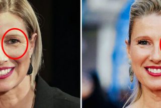 El ojo 'cambado' de Anne Igartiburu