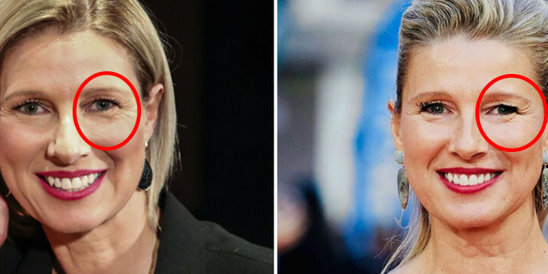 El ojo 'cambado' de Anne Igartiburu