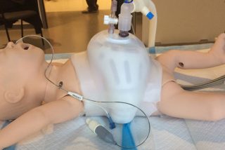 As&iacute; es el peque&ntilde;o chaleco que podr&iacute;a ayudar a los beb&eacute;s enfermos a respirar mejor