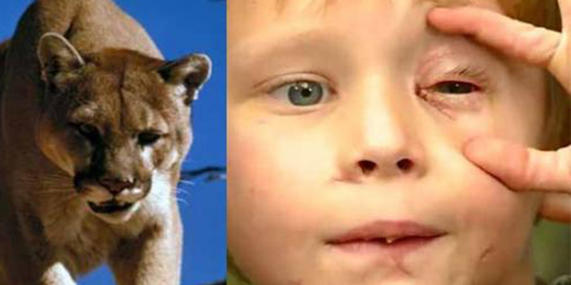 Este ni&ntilde;o logra sobrevivir forcejeando con una puma que apres&oacute; su cabeza entre sus fauces