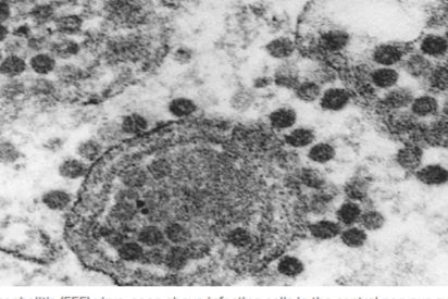 Tres estadounidenses han muerto tras contraer un virus raro propagado por mosquitos que infecta el cerebro