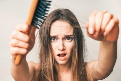 Caída del cabello, pelo, alopecia.
