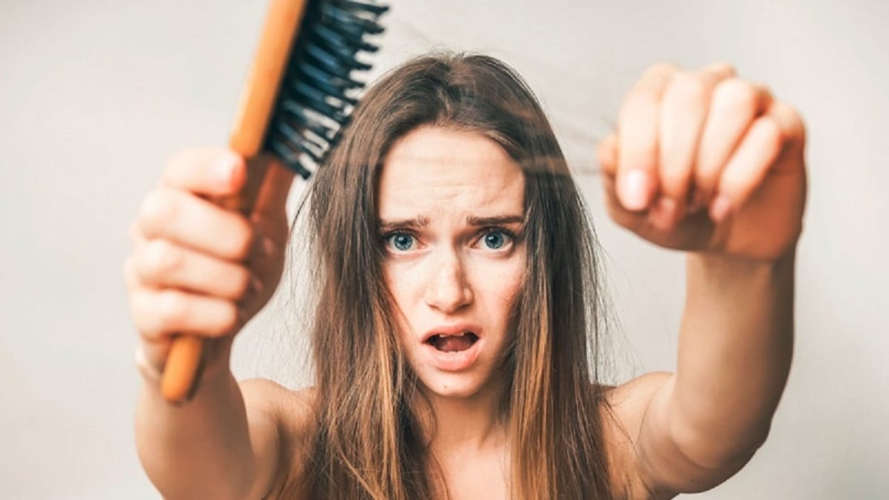 Caída del cabello, pelo, alopecia.