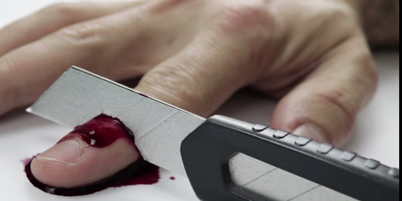 Ir&aacute;n: Le cortan los dedos a un hombre como castigo por robar