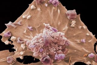 Los cient&iacute;ficos buscan detectar las se&ntilde;ales m&aacute;s precoces del c&aacute;ncer antes de que emerja