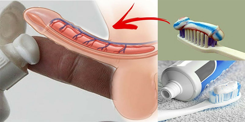 Los m&eacute;dicos advierten que dejen de aplicar pasta de dientes en sus genitales &iexcl;Es muy peligroso!