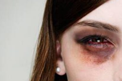 Momento en que la Polic&iacute;a atrapa al facineroso que pega un pu&ntilde;etazo en un ojo a una se&ntilde;ora por sacar la bandera espa&ntilde;ola cerca de un mitin de Pedro S&aacute;nchez