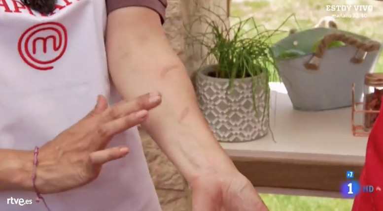 Tamara Falc&oacute; da un gran susto al quemarse los brazos durante la prueba de exteriores de MasterChef Celebrity
