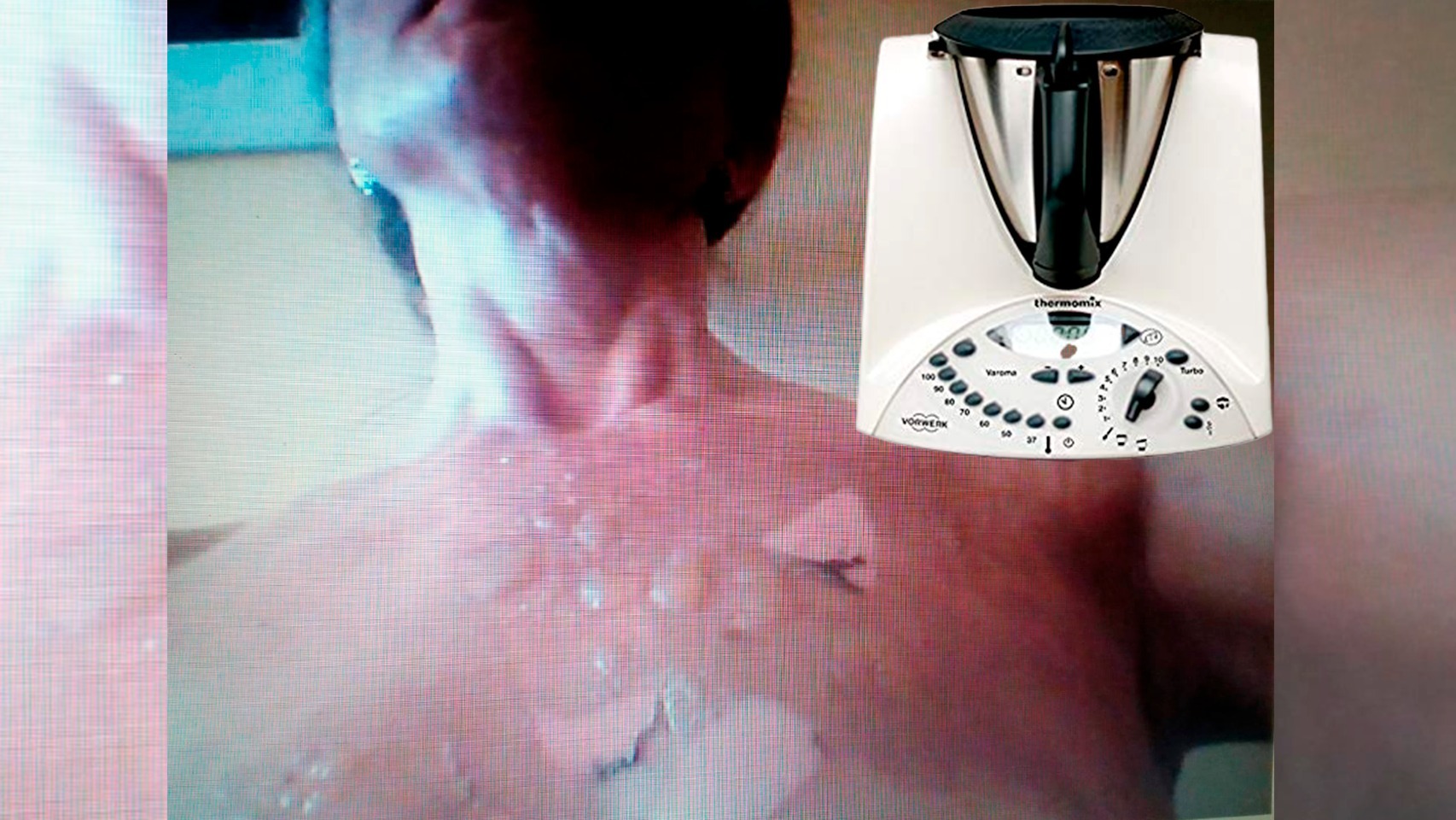 Marcelina ha ganado su batalla legal contra Thermomix: se quemó tras estallarle la tapa y le pagan 24.000€