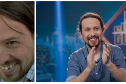 Pablo Iglesias le hinca el diente al cierre de campa&ntilde;a electoral estrenando su caro tratamiento dental
