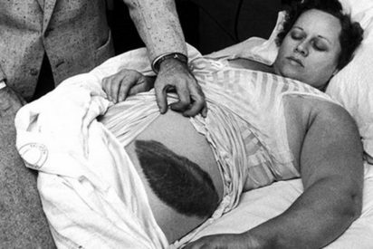 La abracadabrante historia de la &uacute;nica persona herida por un meteorito
