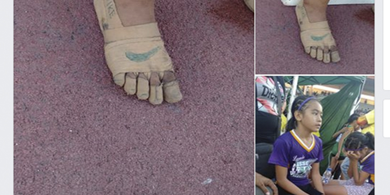 Esta ni&ntilde;a usa 'zapatillas' para correr hechas con vendajes y gana tres medallas de oro