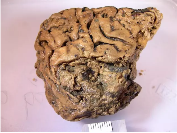 Los secretos del cerebro humano 'momificado' en lodo durante 2.600 a&ntilde;os