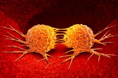 C&aacute;ncer: &iquest;qu&eacute; es la met&aacute;stasis?