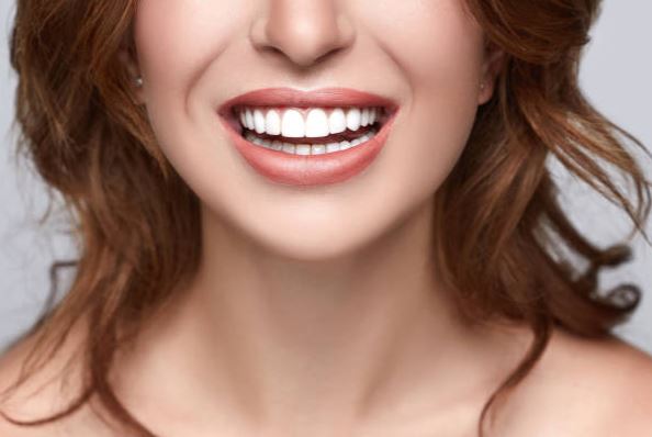 blanqueamiento dental