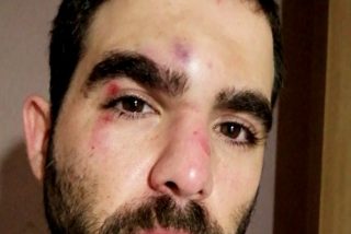 Barcelona: la brutal paliza a un periodista de Onda Cero en la ciudad sin ley de Ada Colau