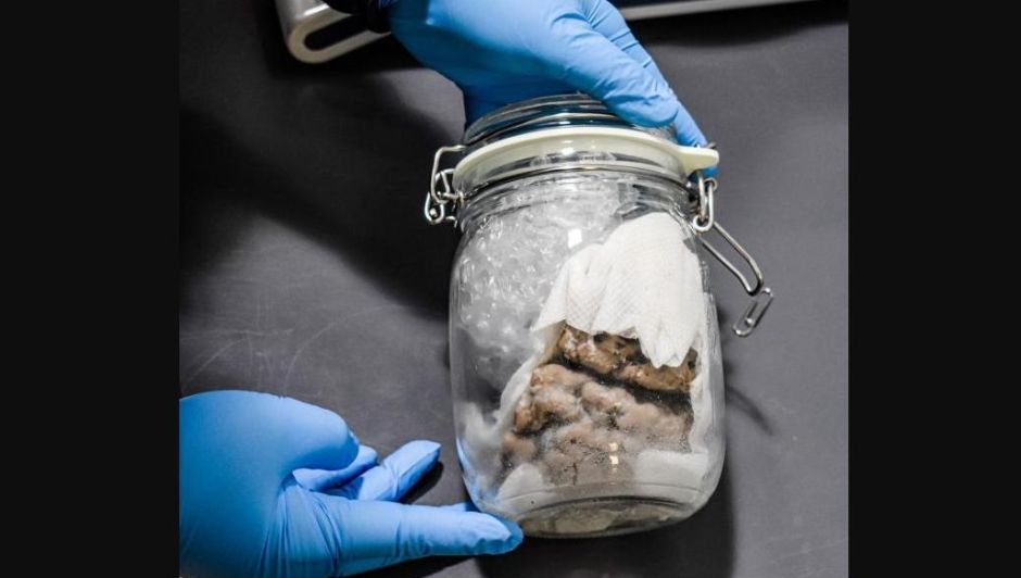 Canad&aacute;: env&iacute;an un cerebro humano a trav&eacute;s de un servicio de&nbsp;paqueter&iacute;a