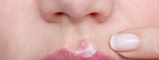 Mejores parches para granos 2023 ✅