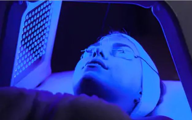  terapia de luz azul para el acné 