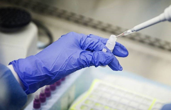 Rusia culmina con éxito un ensayo clínico en humanos de la vacuna contra el coronavirus