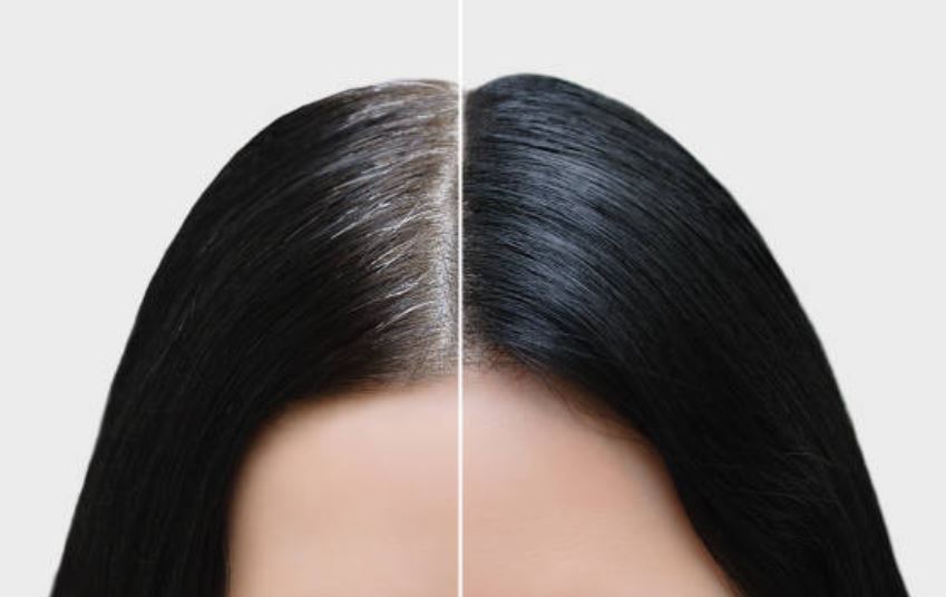 Mejores anticanas 2022