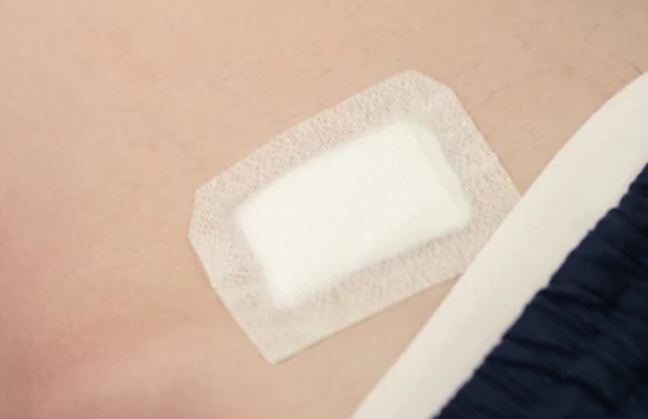  parches reductores de cicatrices